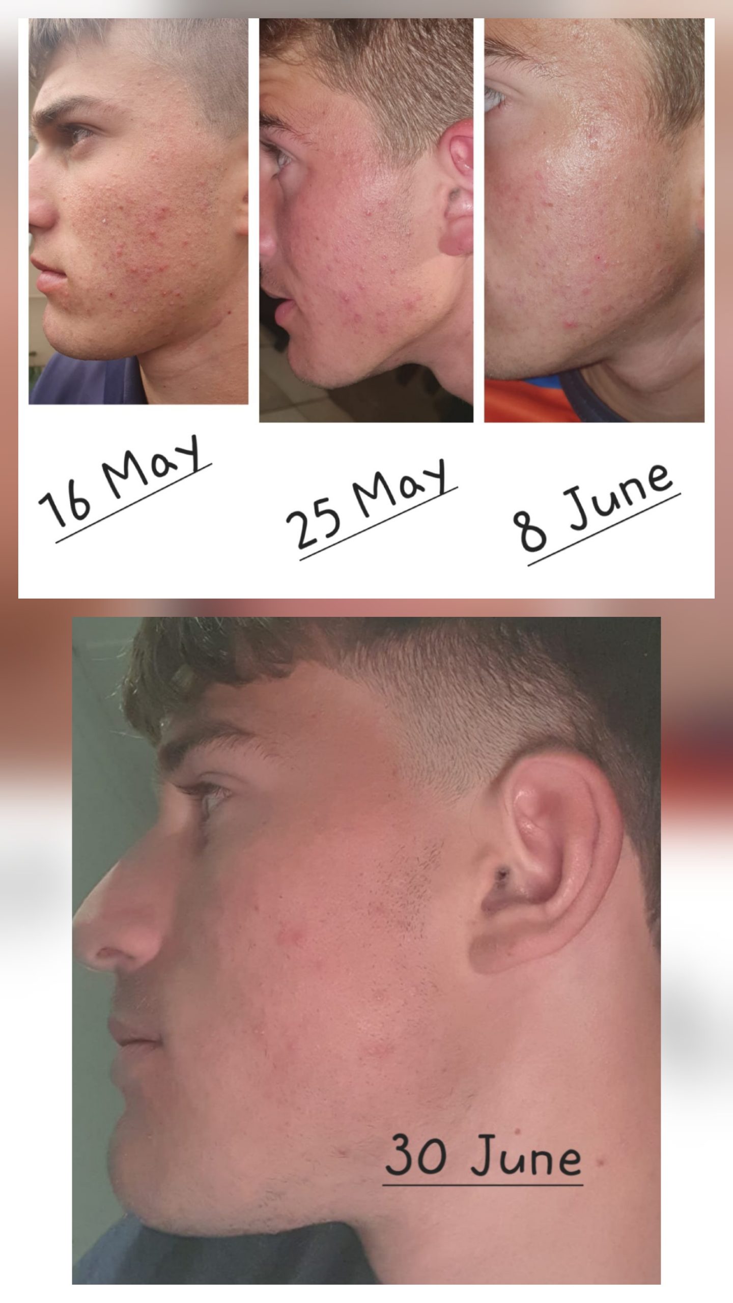 Exfoliating Elixir - Image 3