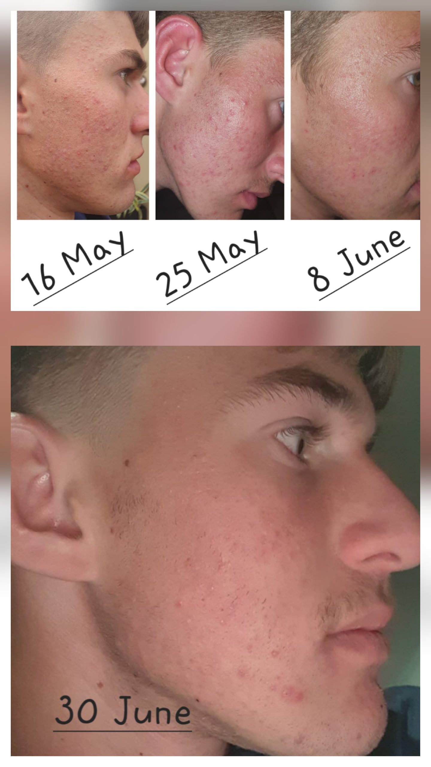 Exfoliating Elixir - Image 2