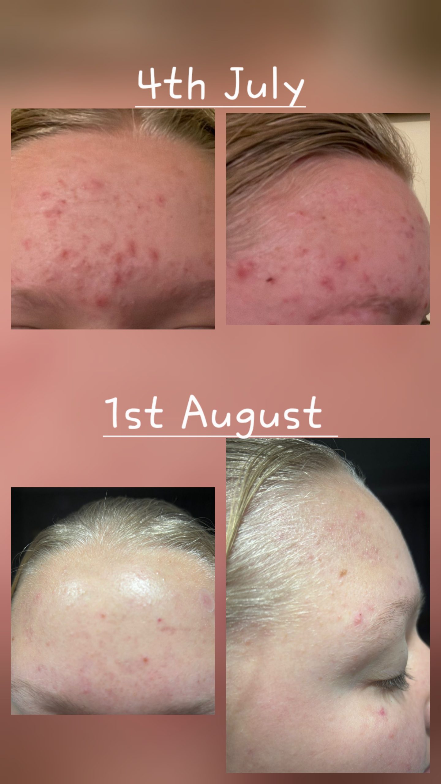 Exfoliating Elixir - Image 4